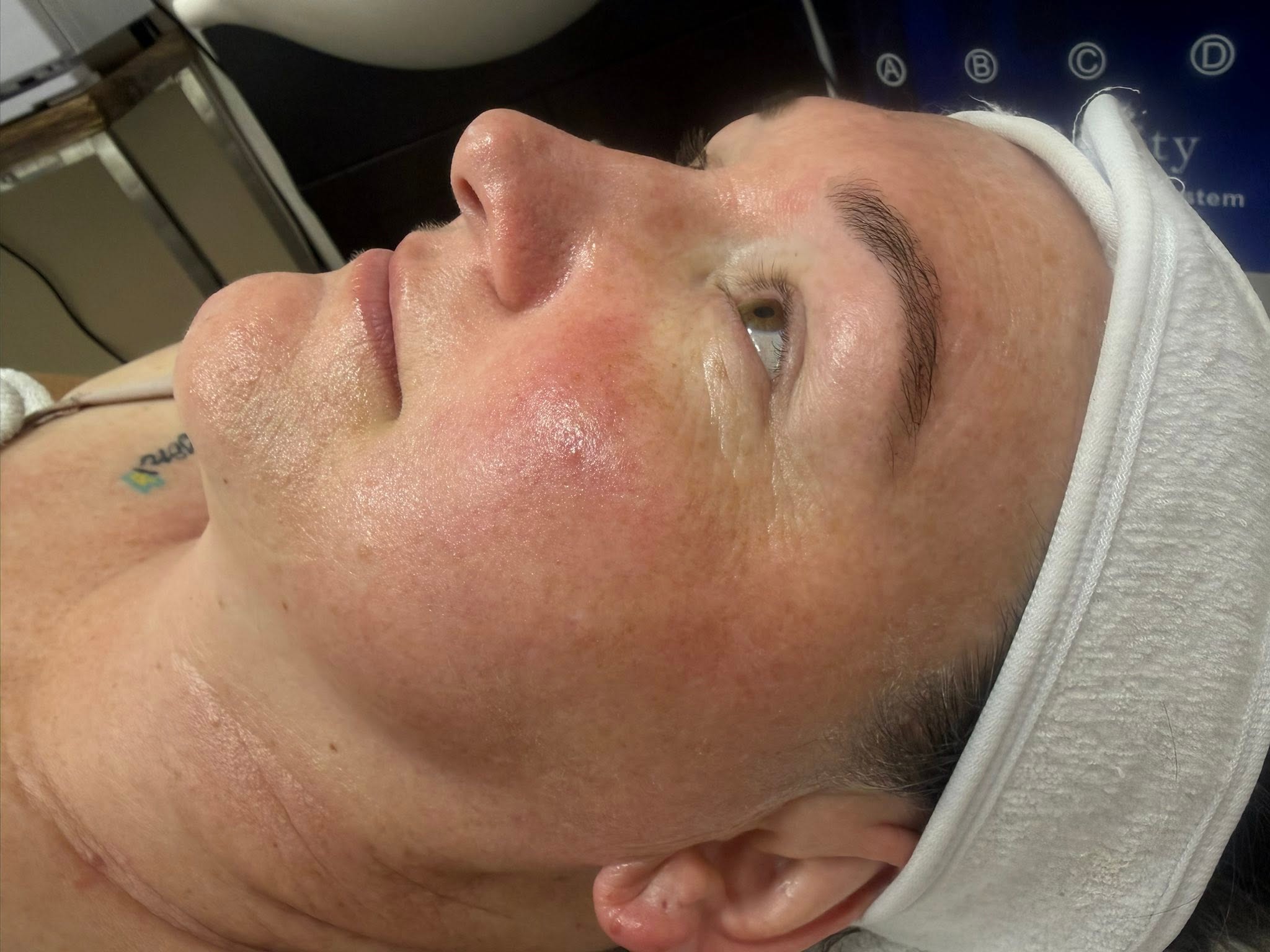 Lena Beauty Result