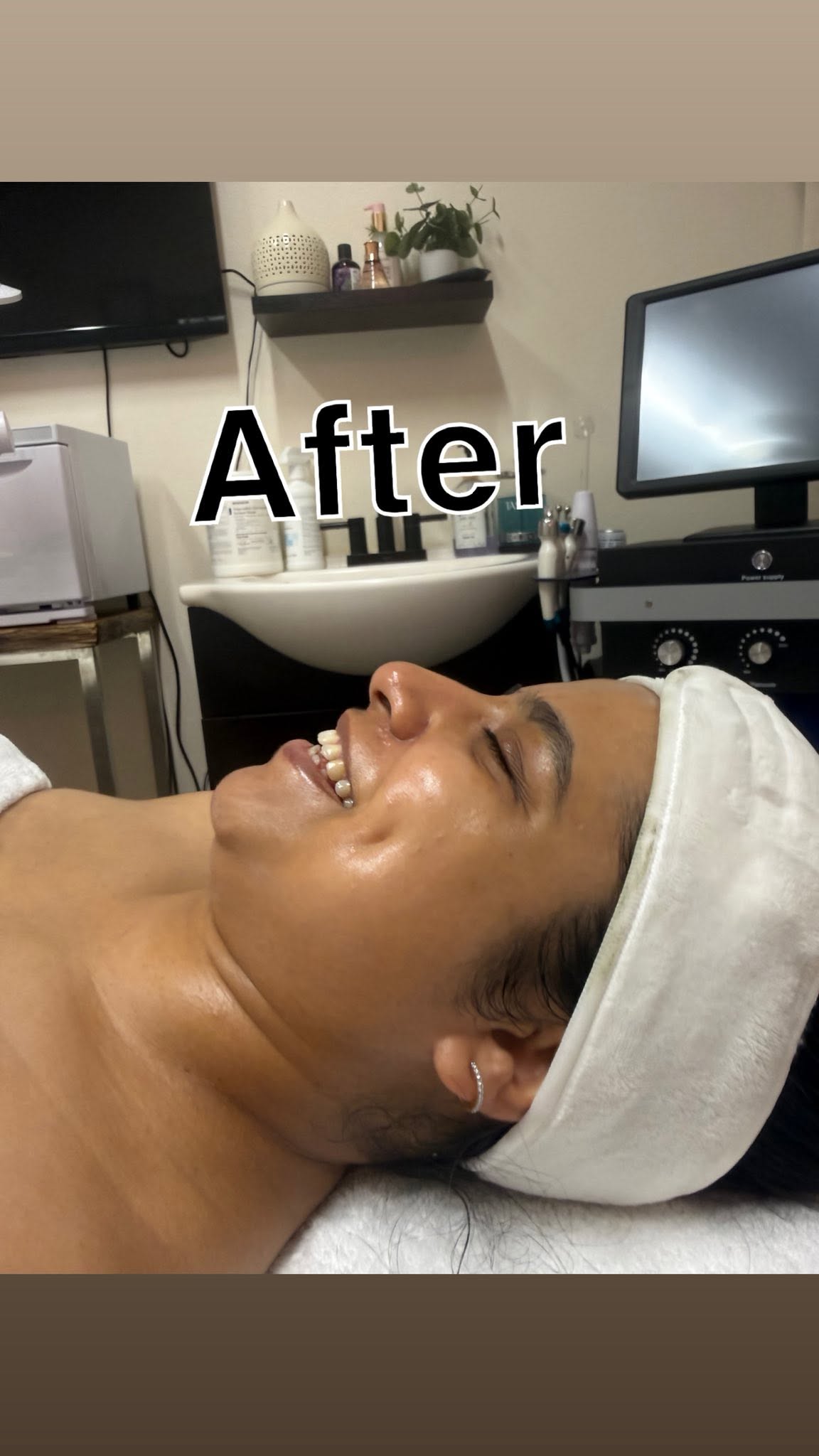 Before & After